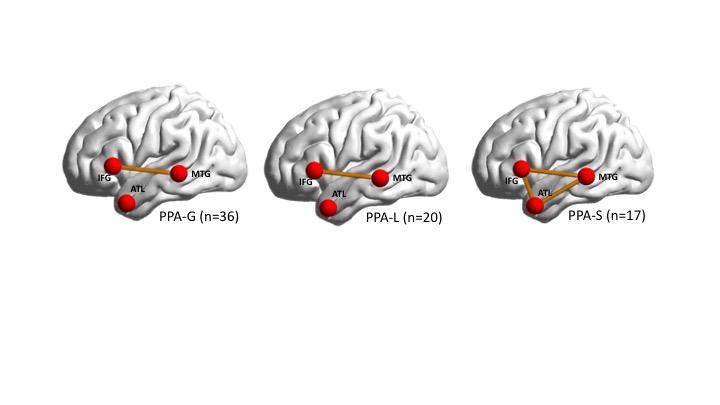 Illustration of the three brain