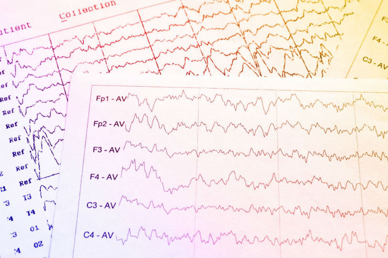 EEG Electrophysiological